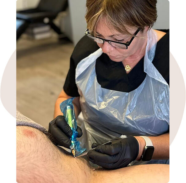 Cryotherapy