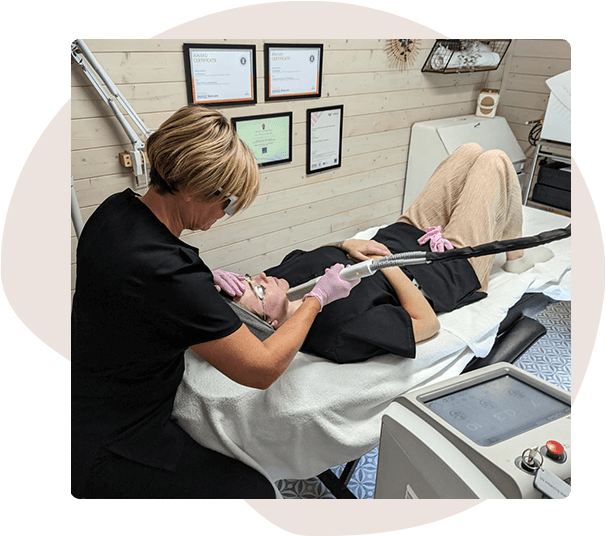 Laser skin rejuvenation/Laser genesis