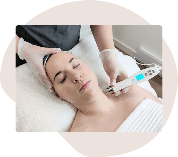 Radio Frequency Microneedling